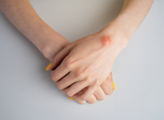 Ganglion Kistine Dikkat!